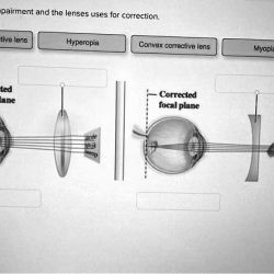 Label the visual impairment and the lenses uses for correction.