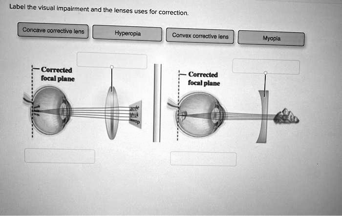 Label the visual impairment and the lenses uses for correction.